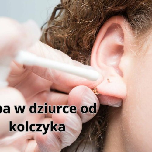 Ropa w dziurce od kolczyka: jakie są jej przyczyny?